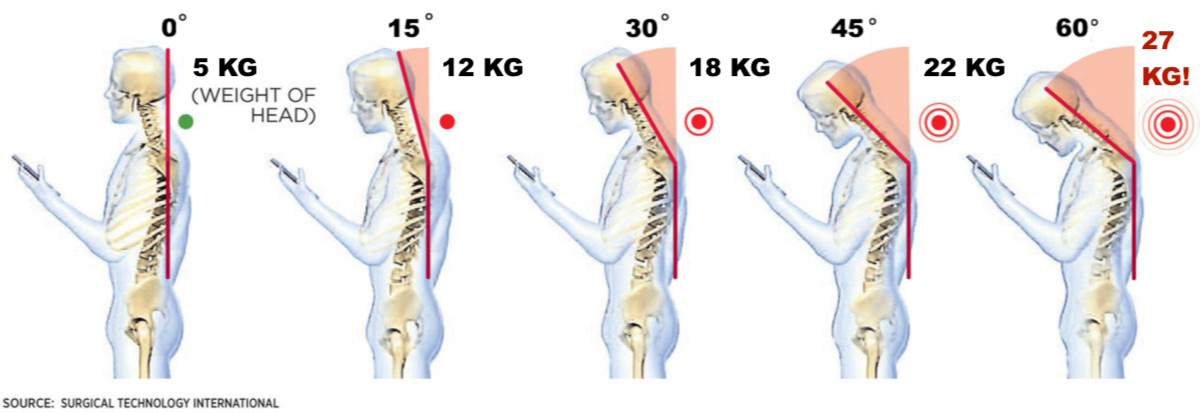 Is your phone giving you tech neck?